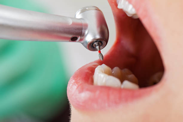 Best Dentist for Dental Trauma  in Buda, TX